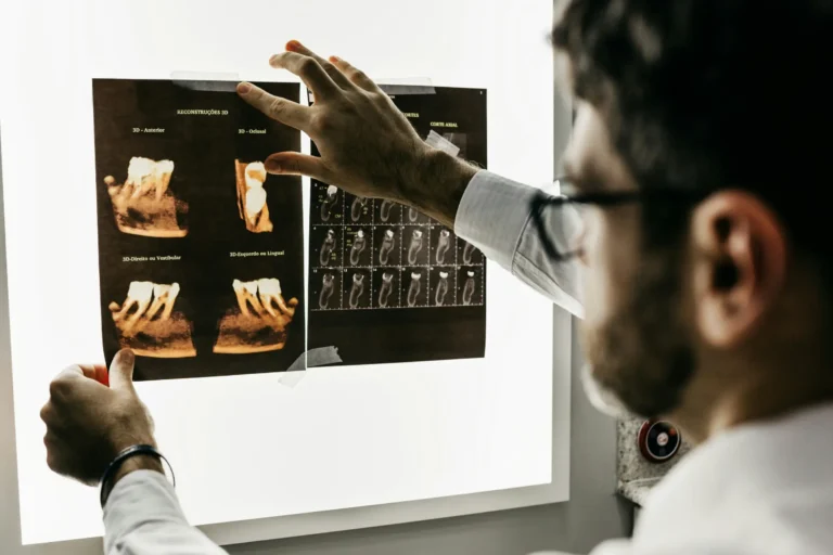 arafed man pointing at a computer screen with a tooth scan