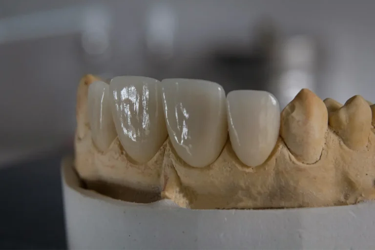 a close up of a tooth with a missing tooth on a table