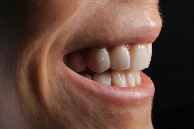 there is a close up of a person ' s mouth with a missing tooth