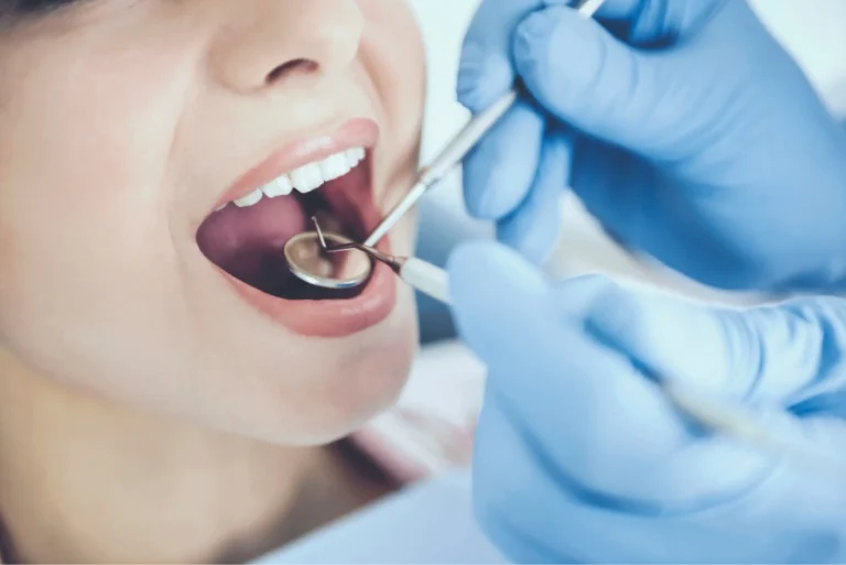 arafed woman getting her teeth brushed by a dentist