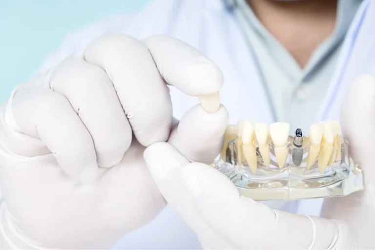 arafed man in white gloves holding a dental device with a tooth