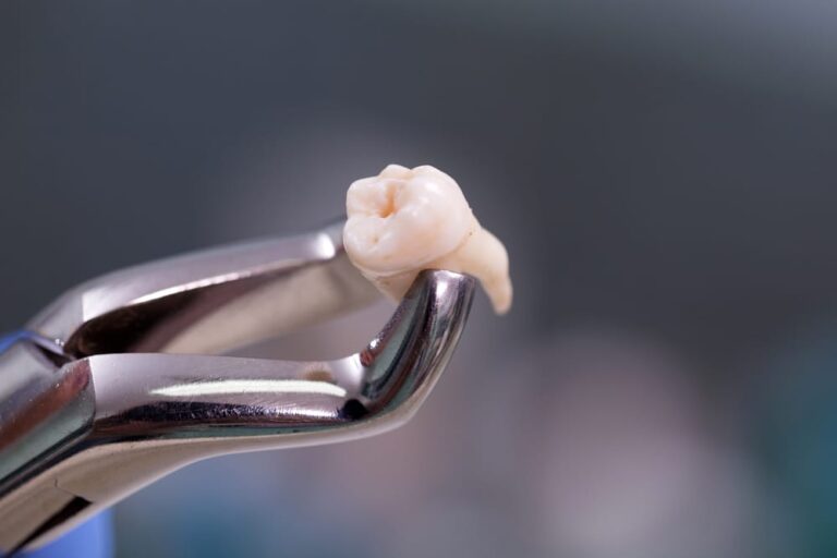 a close up of a tooth being held by a pair of pliers