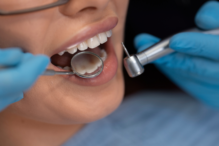 arafed woman getting her teeth brushed by a dentist