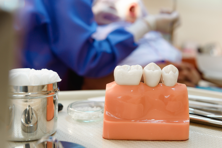 there is a model of a tooth with a toothbrush on a table