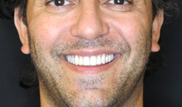 smiling man with a black shirt and a tie and a black background