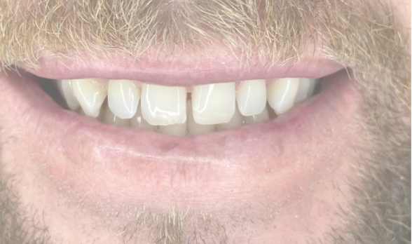 a close up of a man with a beard and a tooth