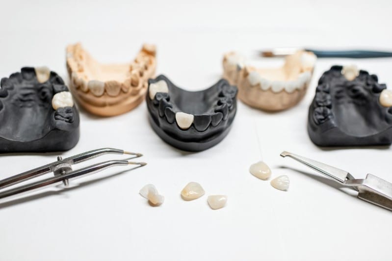 Zirconia crowns are more expensive than porcelain