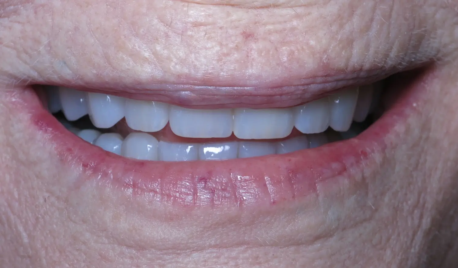 a close up of a person ' s mouth with a missing tooth