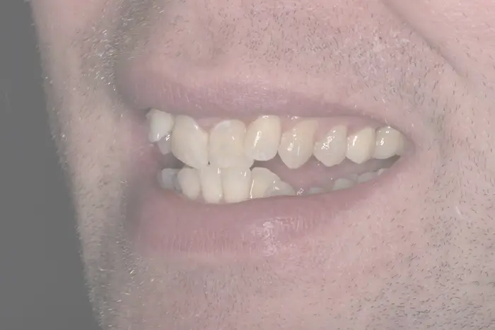 a close up of a man ' s mouth with a missing tooth