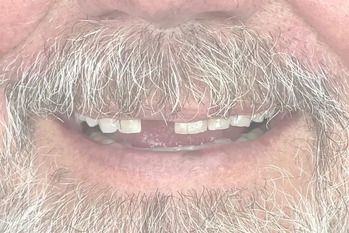 a close up of a man with a beard and a mustache