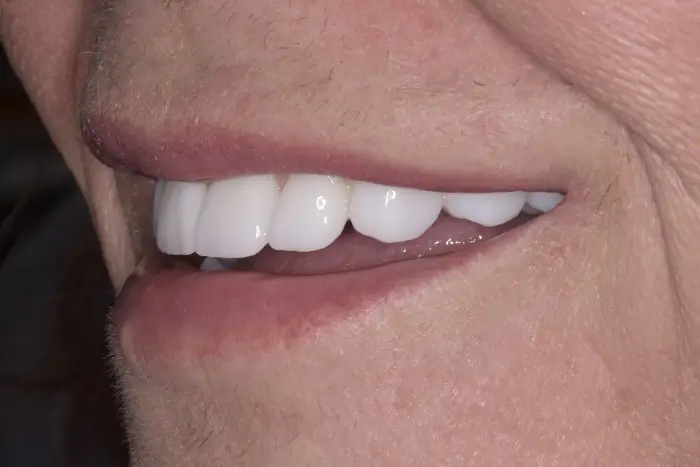 a close up of a person ' s mouth with a toothbrush in it